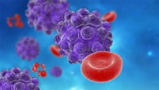 17 случая на морбили са регистрирани в област Враца